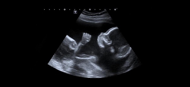 Картинка из свободного доступа в сети.