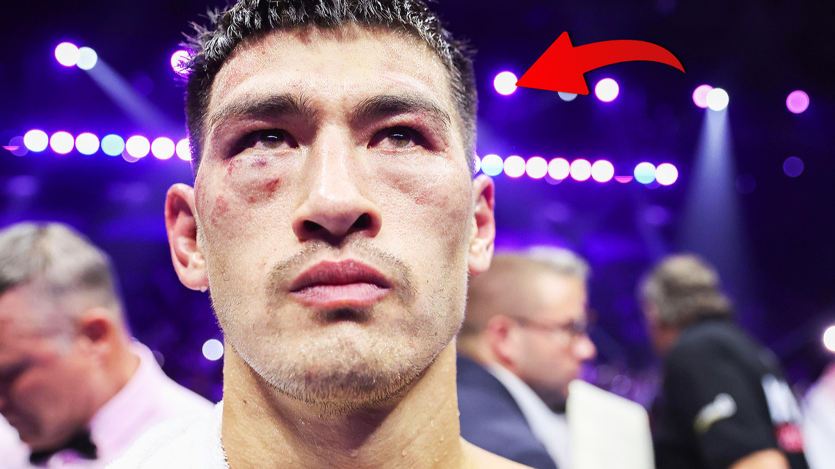 Дмитрий Бивол