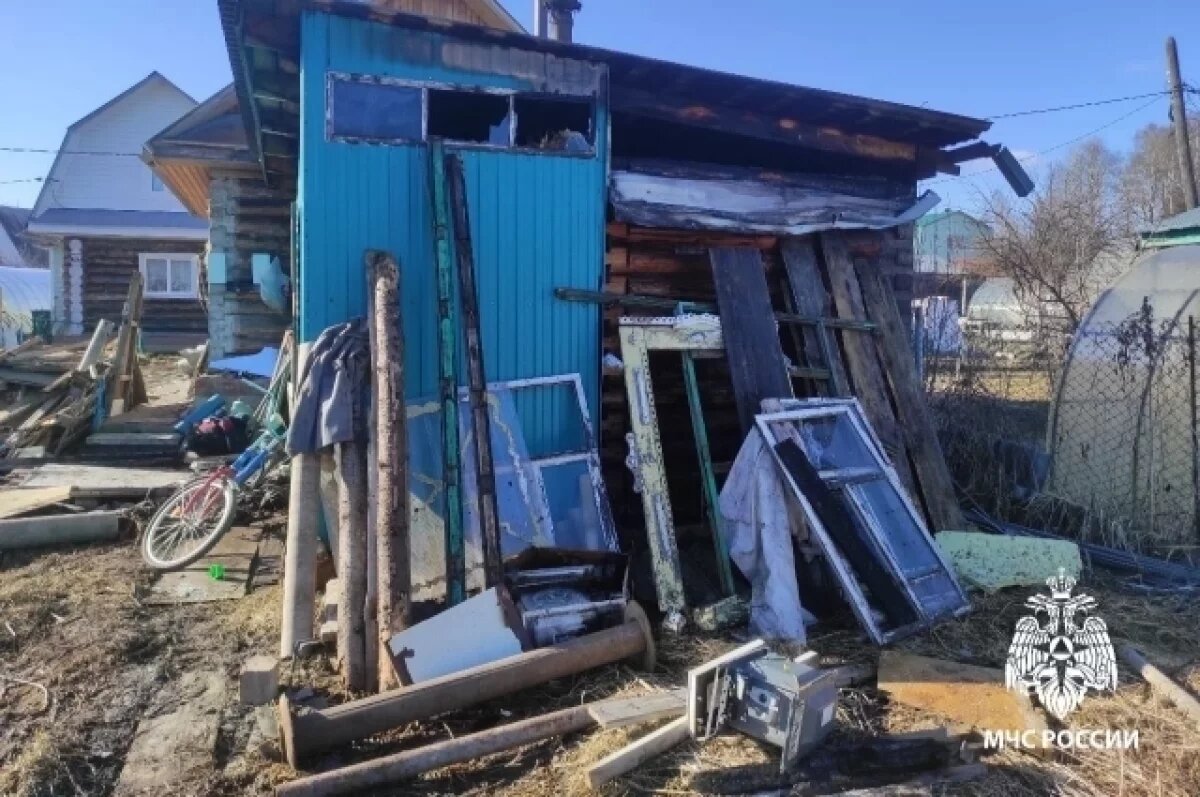    Мужчина получил сильные ожоги на пожаре под Ижевском