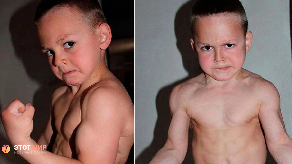 Фото из источника: https://img.tv100.com/rcman