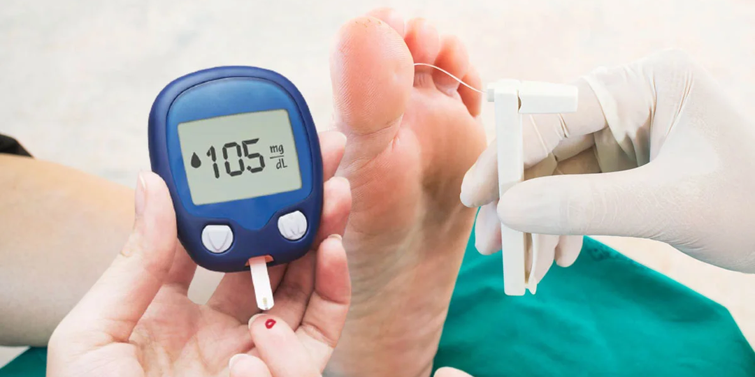 Развитие диабетической стопы: чем это опасно и какой врач нужен – хирург или невролог?