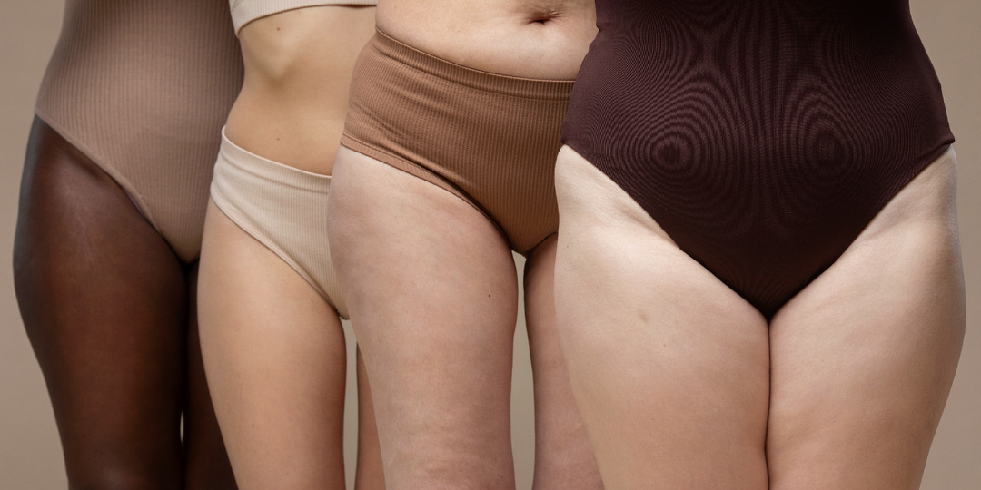 Отеки и целлюлит: что нужно знать и как с этим бороться