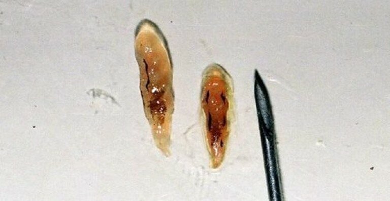 Размер кошачьей двуустки (описторхоз)