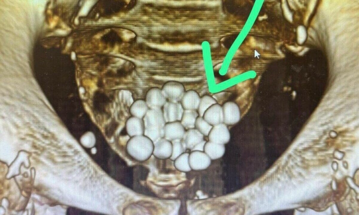    Фото t.me/novorab_official