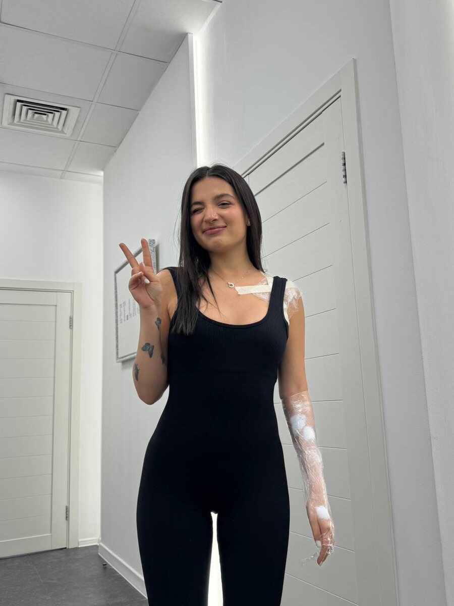 Популярная стримерша и блогер Tenderlybae, известная также как Амина, продолжает процесс сведения своих татуировок. В одном из последних стримов девушка призналась, что сожалеет о большинстве своих тату из-за некачественной работы и стремления к более "чистой" эстетике.

Амина, известная своим ярким и эпатажным образом, решила пересмотреть свое отношение к татуировкам. На стриме она откровенно поделилась с подписчиками, что многие тату были сделаны спонтанно и не соответствуют её нынешним вкусам и представлениям о красоте.

"Я хочу, чтобы моя кожа была чистой. Многие татуировки были сделаны давно и не очень качественно, я о них жалею," – рассказала Tenderlybae своим зрителям.

Девушка уже начала процесс сведения татуировок лазером, который является достаточно болезненным и длительным. Однако, Амина настроена решительно и готова пройти через все этапы, чтобы добиться желаемого результата.

Поклонники Tenderlybae разделились во мнениях по поводу её решения. Некоторые поддерживают девушку, считая, что каждый имеет право меняться и следовать своим желаниям. Другие же выражают сожаление по поводу того, что Амина избавляется от части своей "фишки" и оригинальности.

Тем не менее, Tenderlybae подчеркнула, что это её личное решение, которое она приняла, опираясь на свои собственные ощущения и стремления к красоте.

