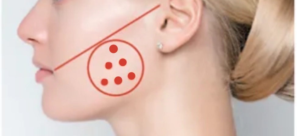 Создано при помощи шедеврум ( нейросеть для генерации изображений)