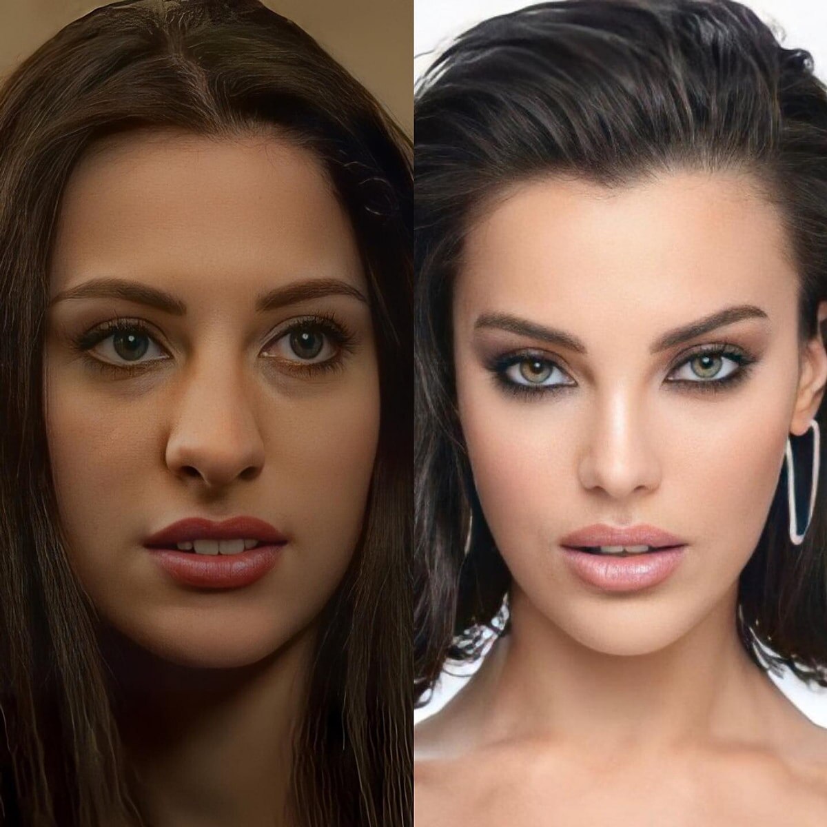 До и после пластики