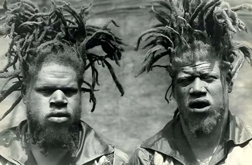 Братья Джордж и Вилли Мьюз родились альбиносами /фото из доступного фонда Яндекс.Картинки/