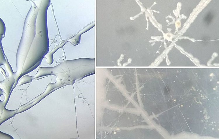     Смогут ли люди повторить опыт природы с полезными грибами и бактериями для своих урожаев
