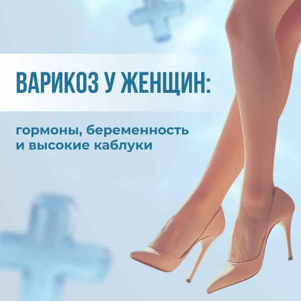 Варикоз у женщин
