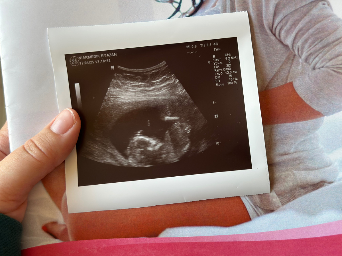 16 недель ровно