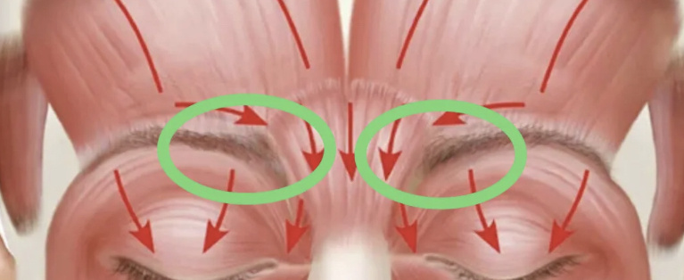 Массаж лица при коррекции межбровных морщин: реально ли достичь ли эффекта?🤔