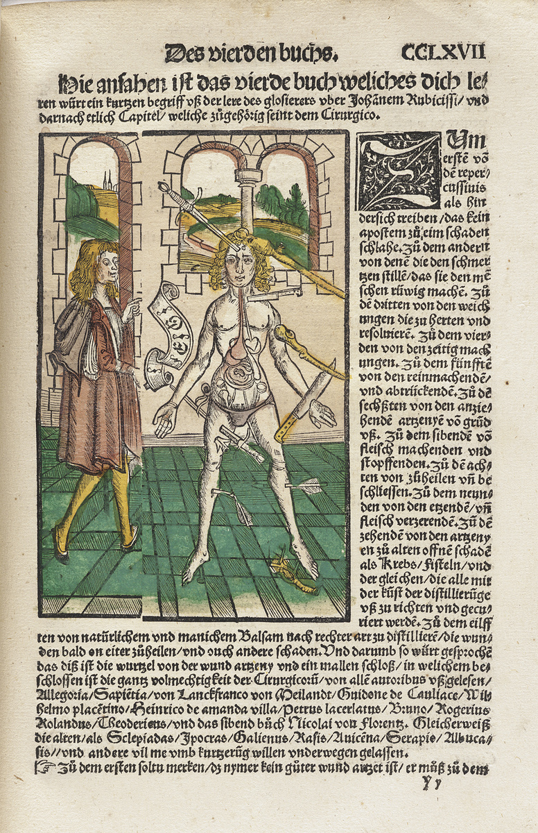 Иероним Брауншвейгский, Liber de Arte Distillandi de Compositis, 1512 год. Раскрашенная гравюра, изображающая «раненого человека». На ней изображены различные раны, которые человек может получить в бою или в результате несчастных случаев.