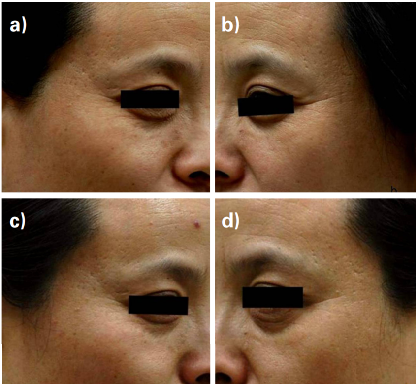 Женщине 50 лет