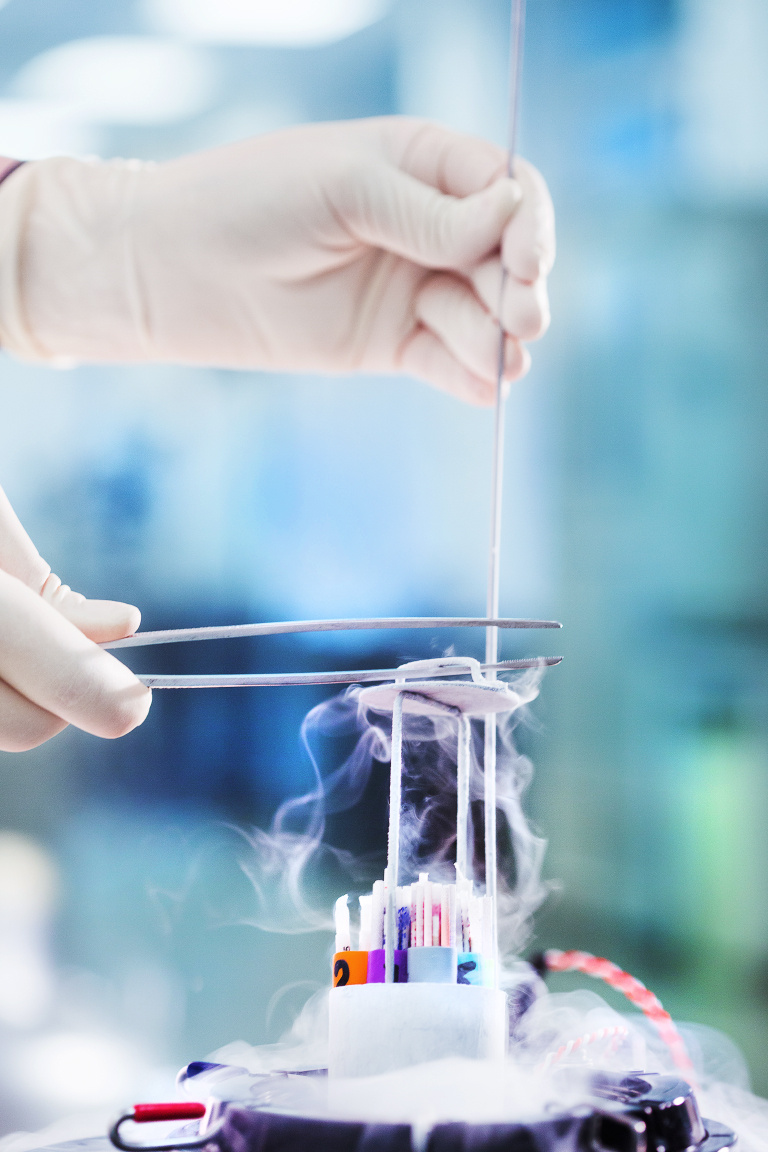 Криоконсервация яйцеклеток