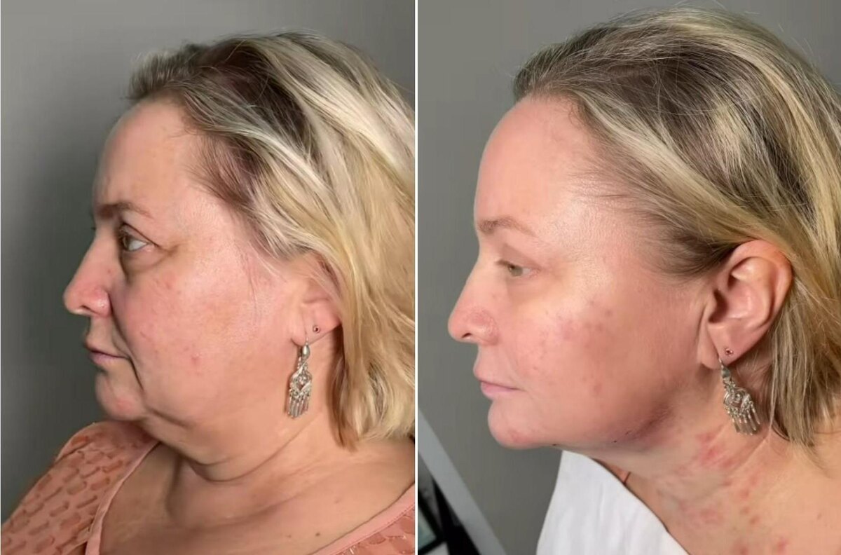 Трансформация налицо