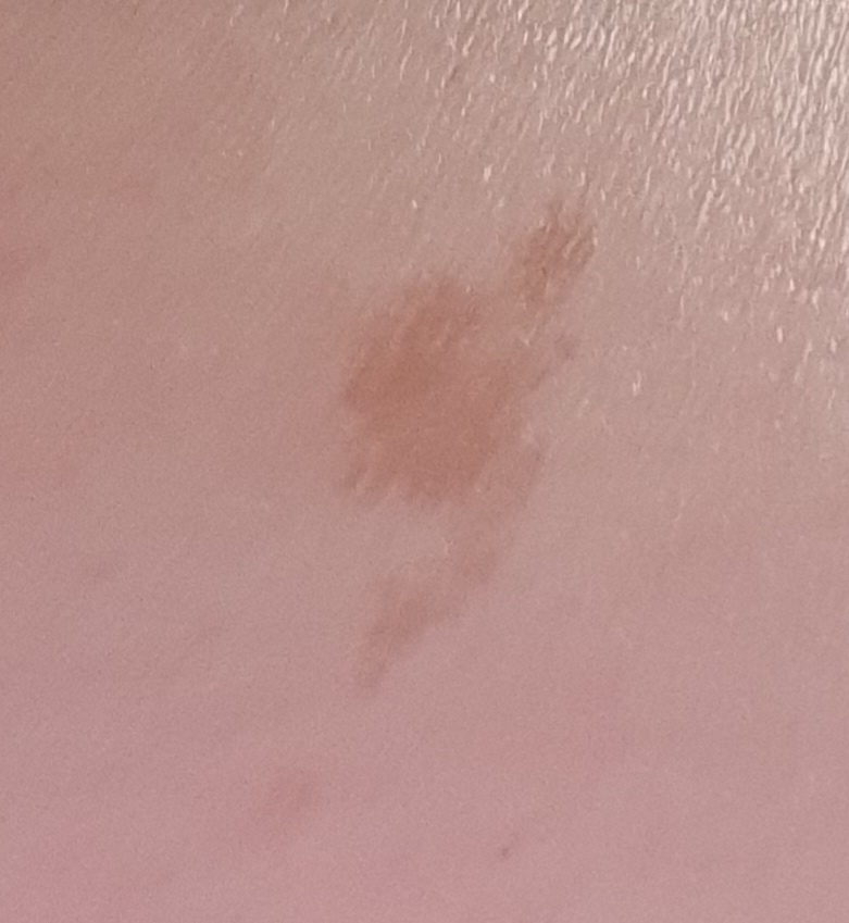 Не было такого при рождении, приобретенное)) 