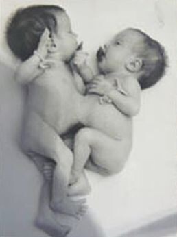    Близнецы. Фото из архива семьи Коркиных