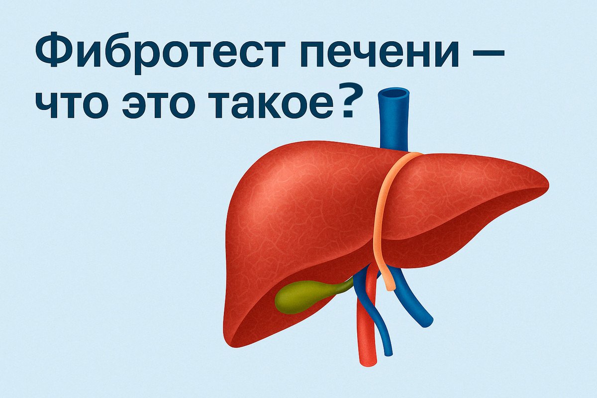 Фибротест - проверь свою печень в Щербинке