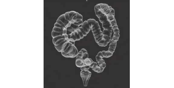 И примерно так она выглядит у пациентки. Кручу-верчу, поместиться хочу. Картинка из интернета.