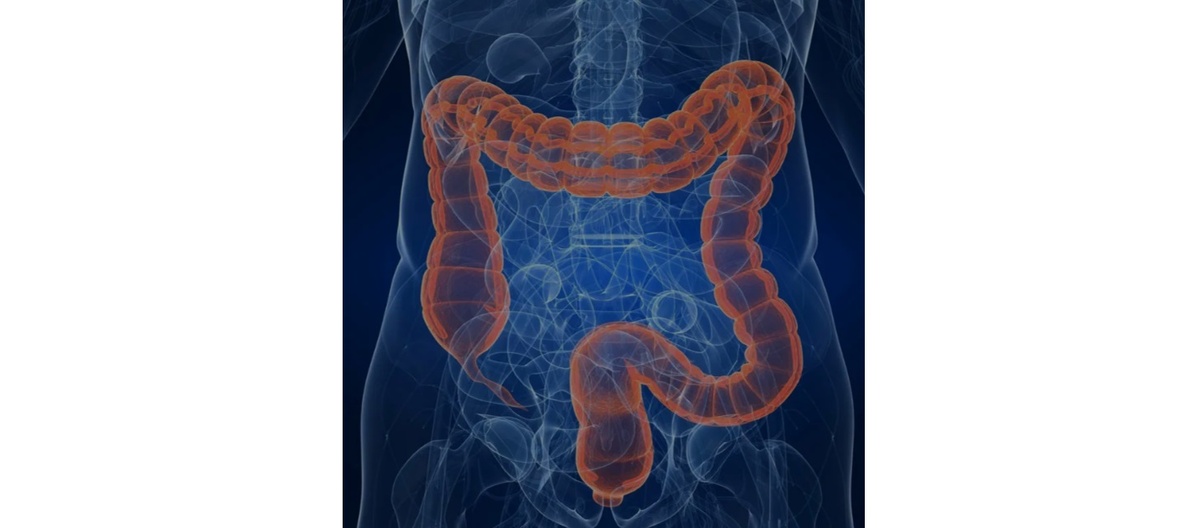 Примерно так выглядит толстая кишка у большинства людей. Картинка из интернета.