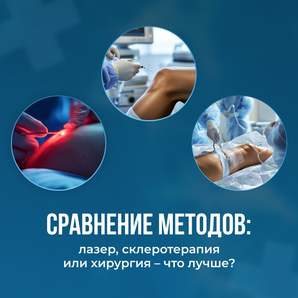 Сравнение методов