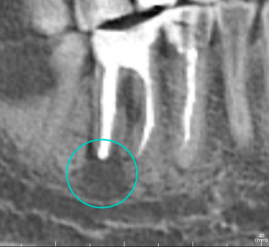 Кейс 1. После