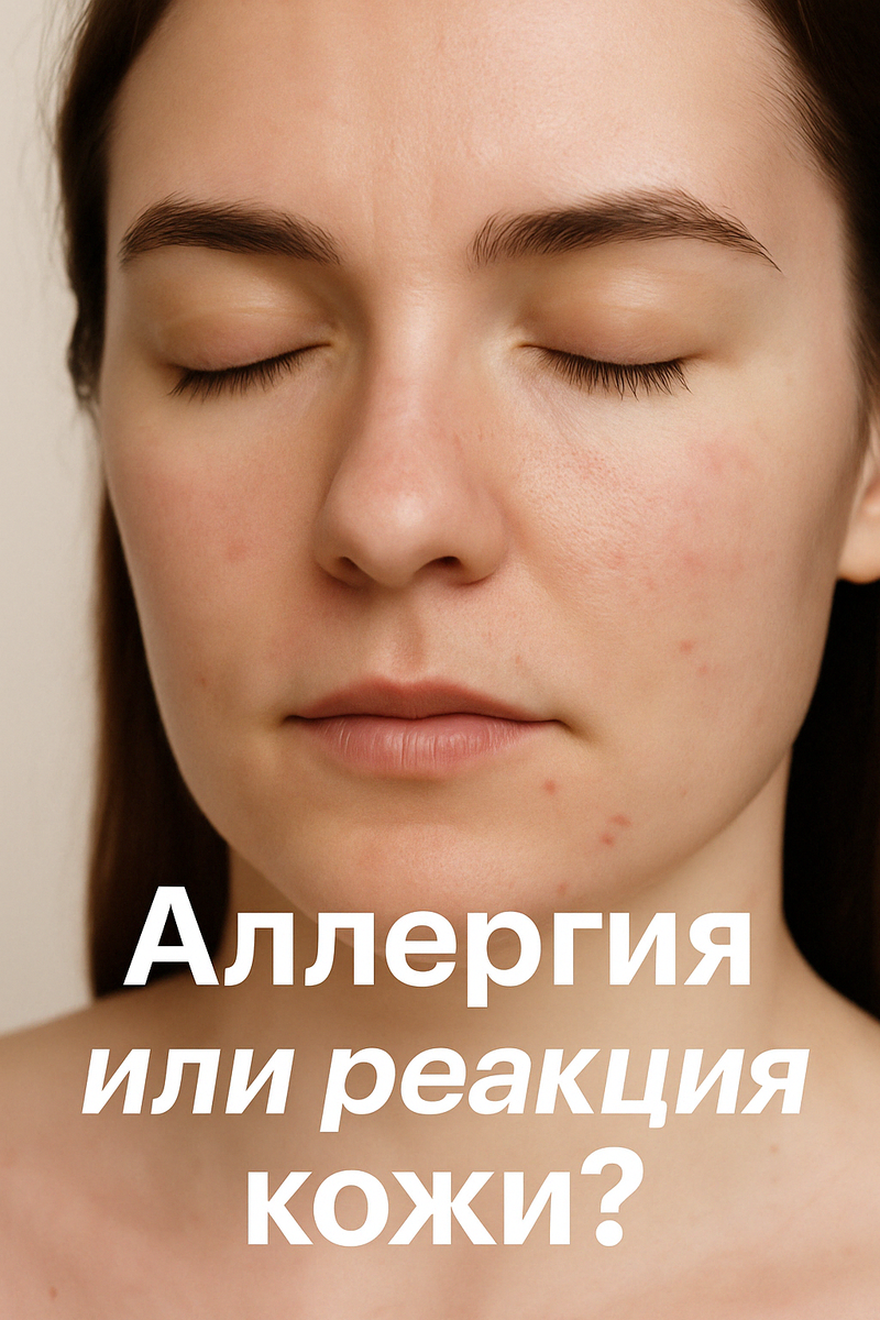 Аллергия или просто истерика кожи? Учимся отличать