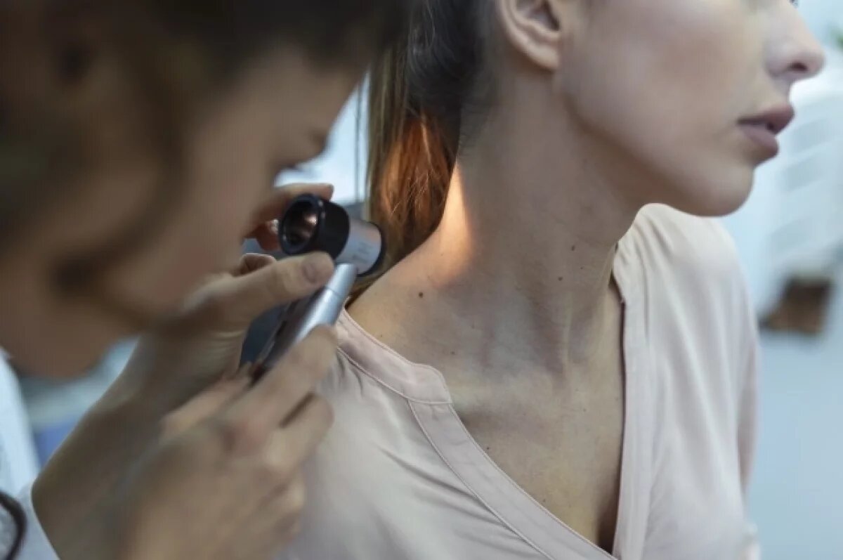    Проверить родинку может врач-дерматолог