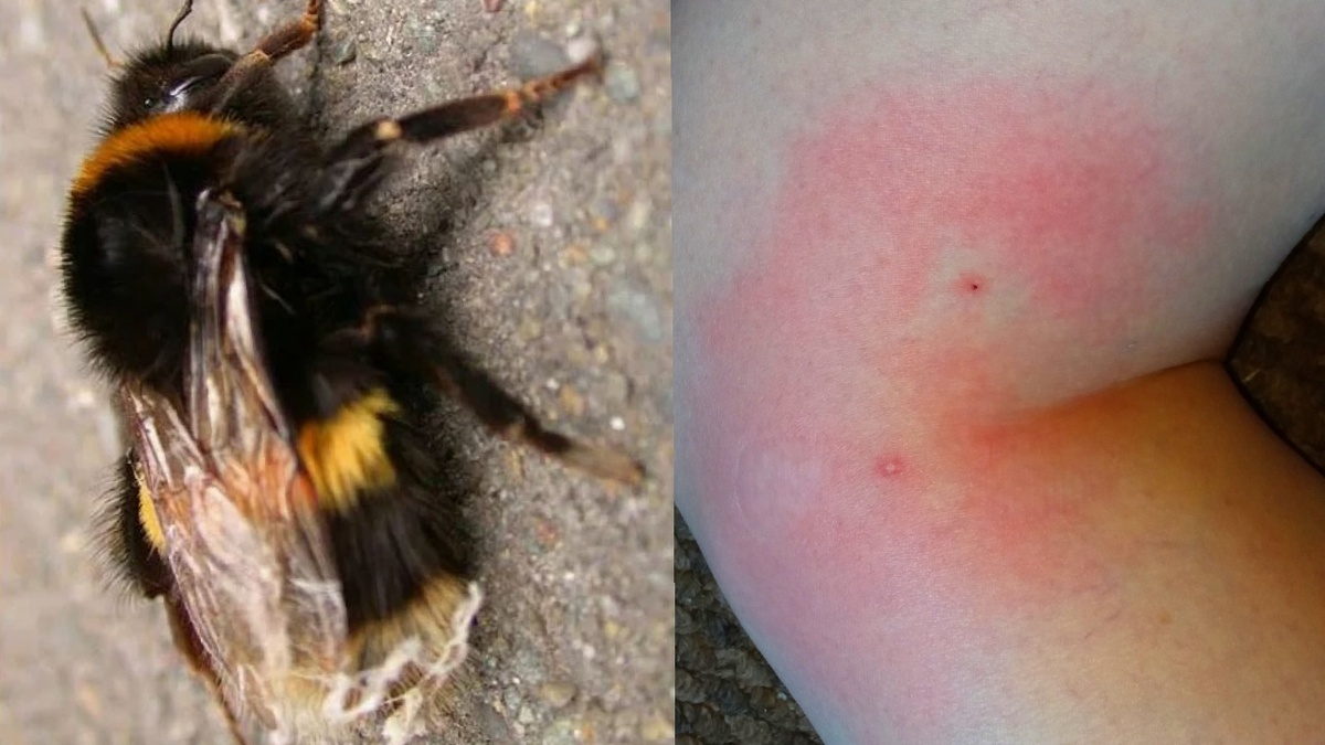 вечер первого дня укуса