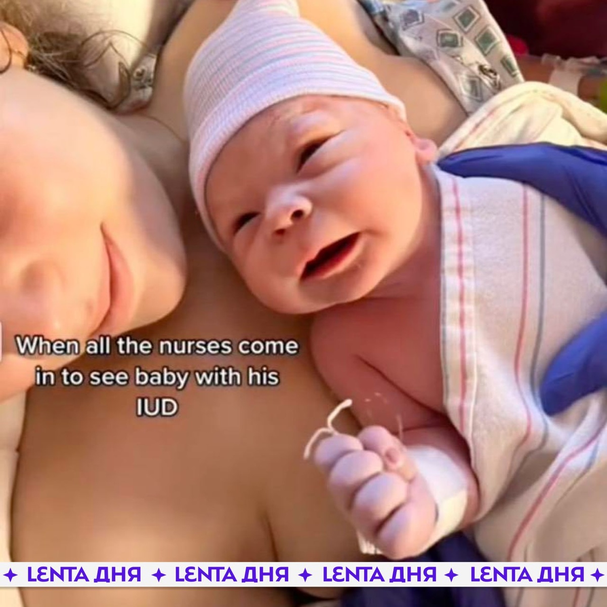 История о том, что ребенок родился со «спиралью» в руке — сказки венского леса. Ребенок развивается в своем плодовместилище, а внутриматочный контрацептив остается снаружи. Источник: Lenta.ru