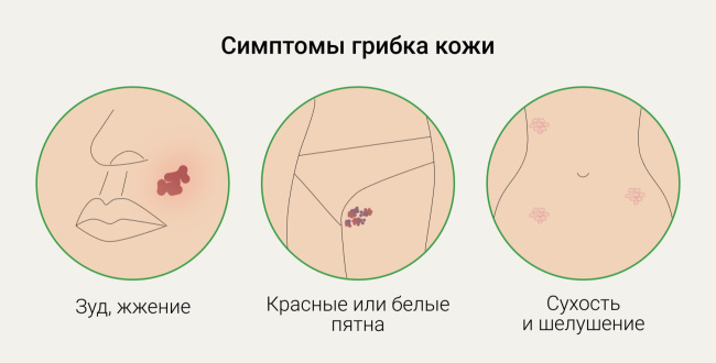 Эффективные способы избавиться от грибка: полное руководство