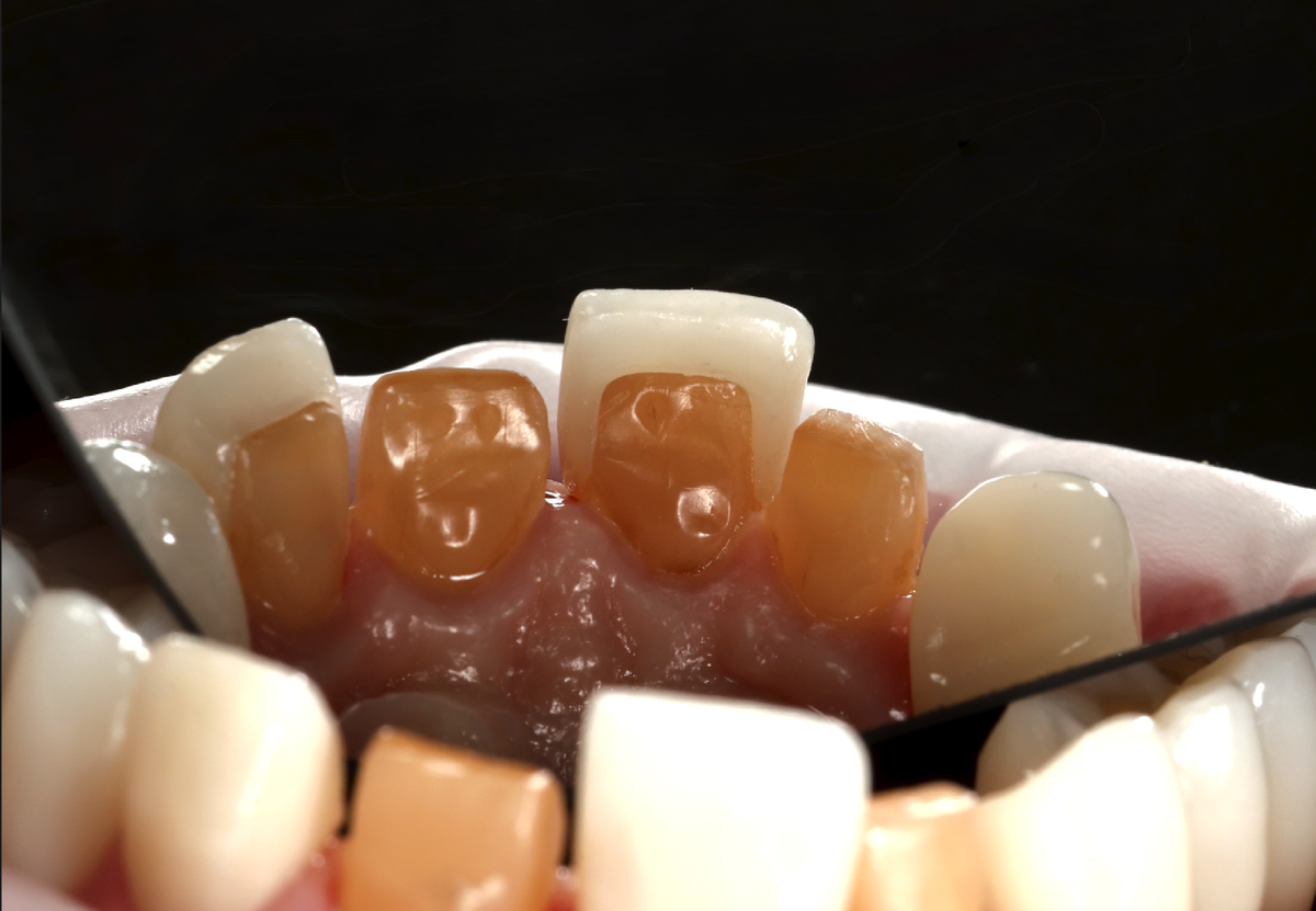 Очень тёмный родной цвет эмали 