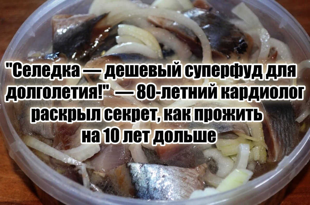 Сразу хочу сказать, что речь идет о домашней селедки собственного приготовления, а не о магазинной.
