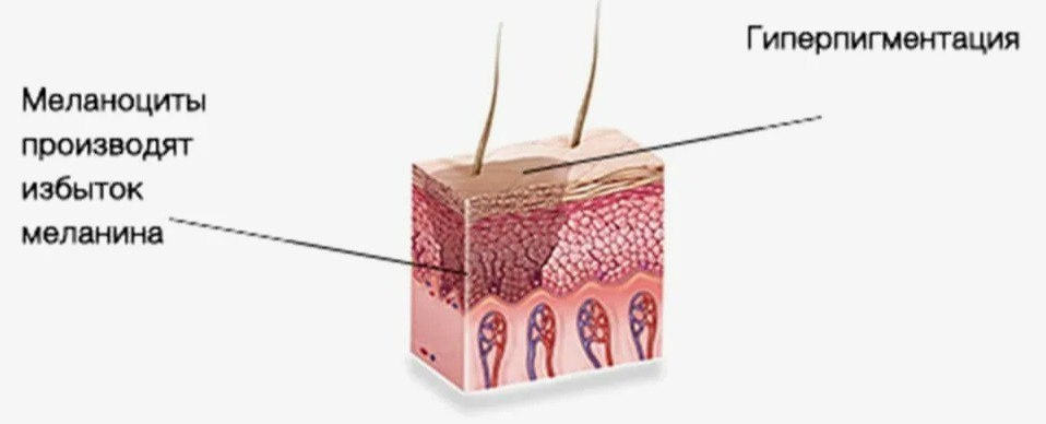 Иллюстрация из открытого Интернет-источника