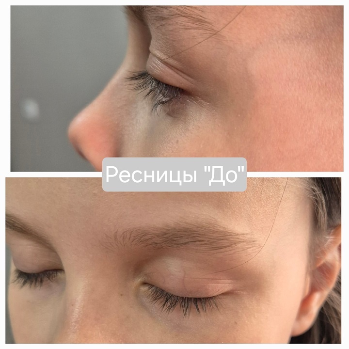 Листайте галерею, чтобы увидеть фото результата