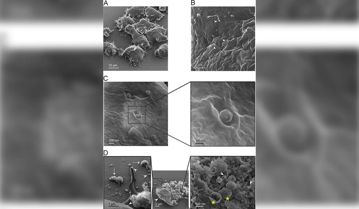    Прикрепление вируса Jyvaskylavirus к клеткам A. castellanii под микроскопом. Источник изображения: popsci.com