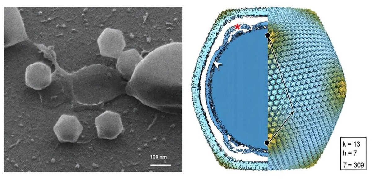    Изображения вируса Ювяскюля. Частица вируса примерно в два раза больше, чем частица гриппа или коронавируса. Источник: popsci.com