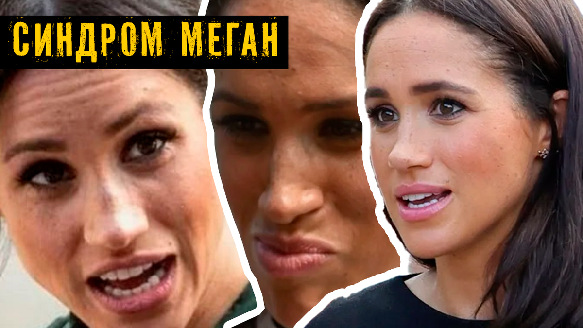 У Меган Маркл синдром СДВГ, а вы смеялись. Особенности развития «особенной» герцогини Сассекской. Как близкие справляются с синдромом Меган?
