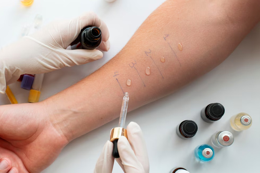      Кожные пробы на аллергию     
Фото: Freepik