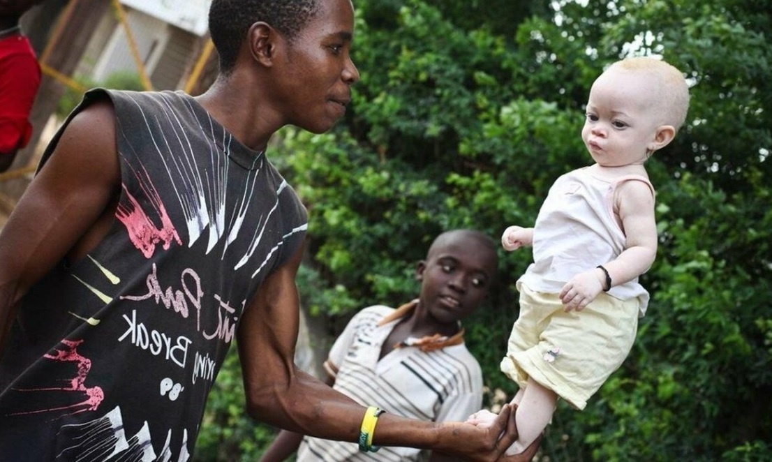 Появление на свет "белого негритёнка" встречается с суеверным страхом.  /из доступного фонда "Яндекс.картинки/