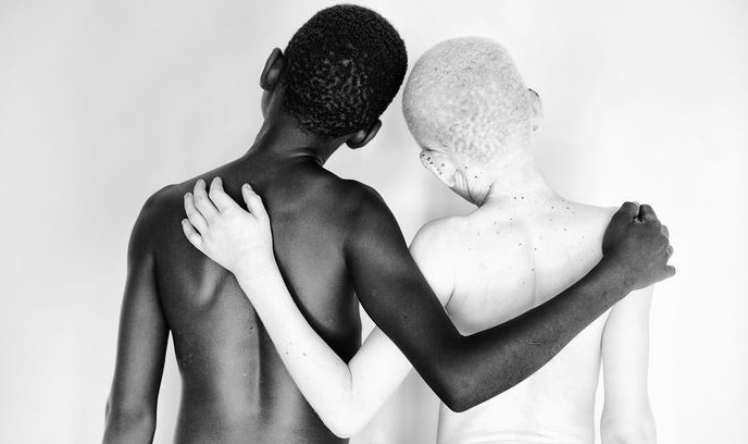 Рождение альбиносов в Африке - очень частое явление . Почему? /из доступного фонда "Яндекс.картинки/