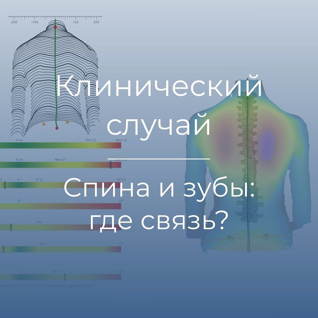 Казалось бы: где зубы, а где спина? 