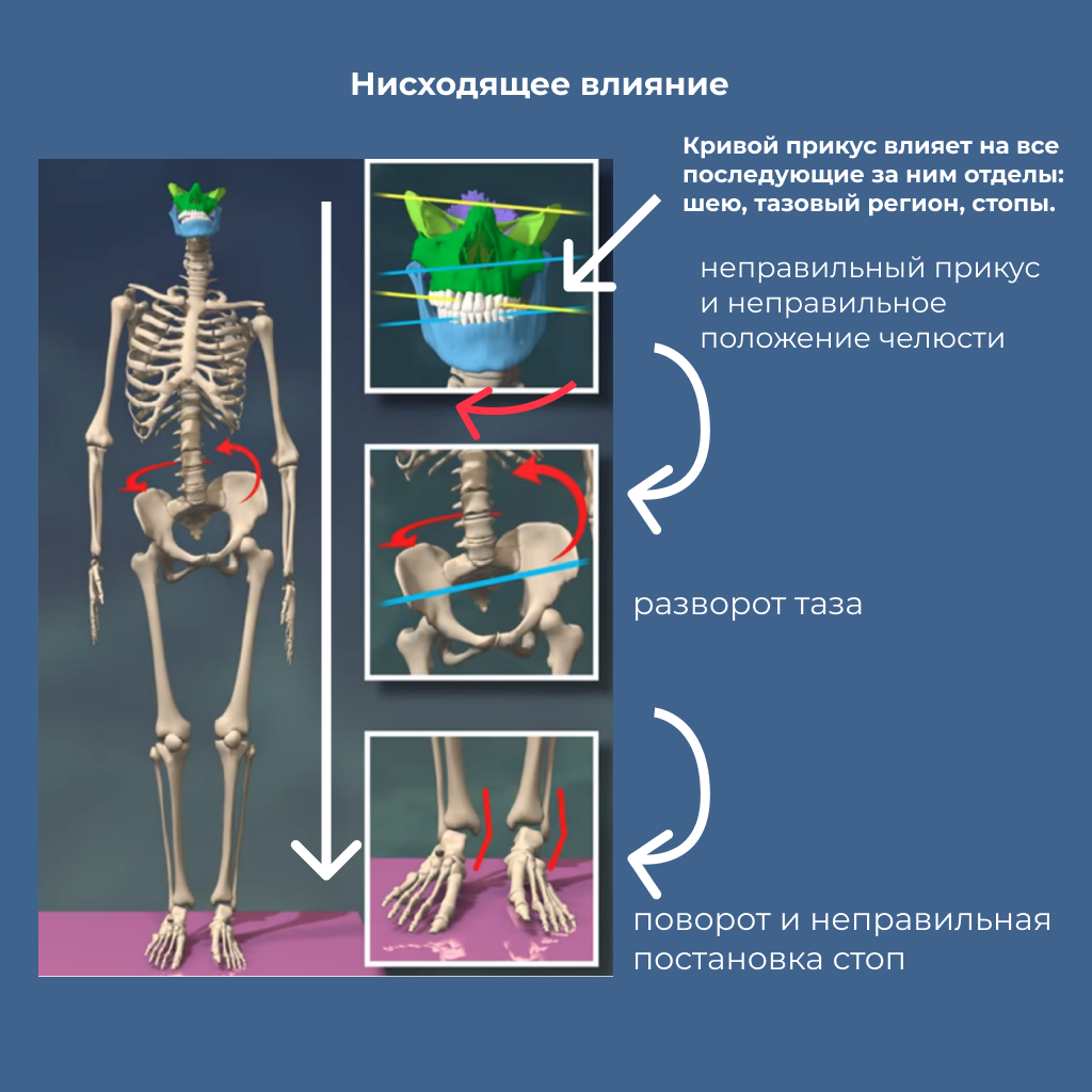 Изменение прикуса всегда влияет на изменение положения таза и постановки стоп