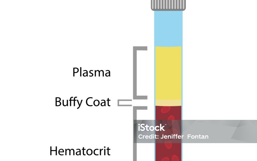 Густая кровь и высокий гематокрит: что это значит и чем опасно
