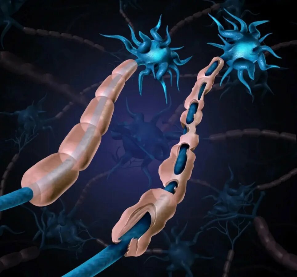 Миелиновые оболочки зарисованы бежевым цветом