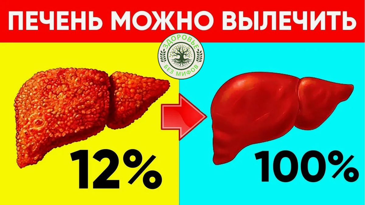 До - после....