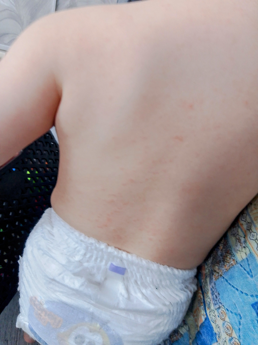 Здесь конечно плохо видно, но разглядеть можно