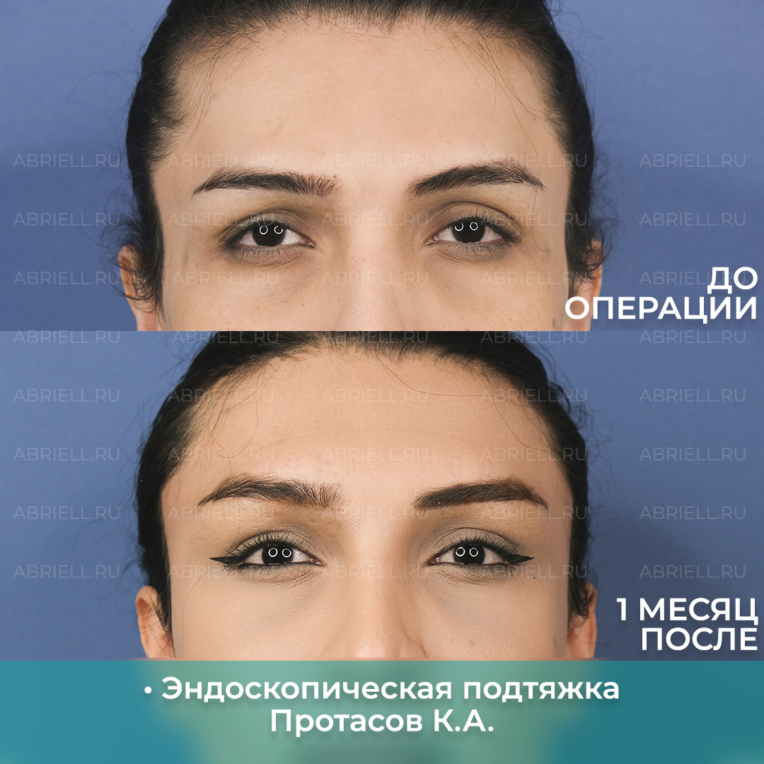 Пластический хирург: Протасов К.А. 