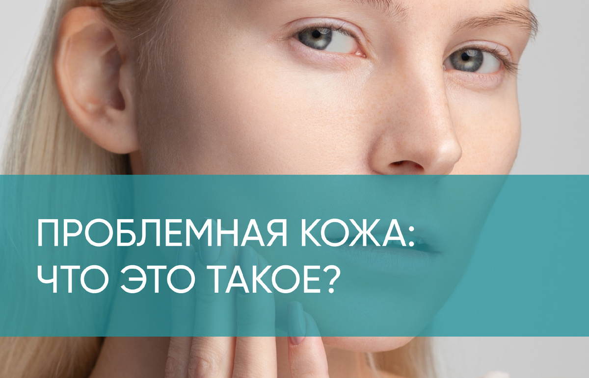 Что такое проблемная кожа?